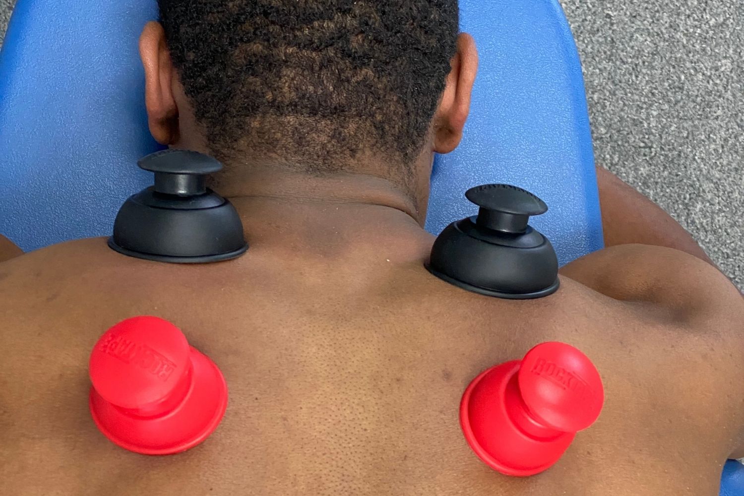 cupping image